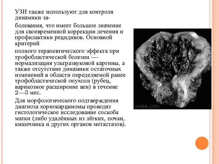 УЗИ также используют для контроля динамики за- болевания, что имеет большое значение