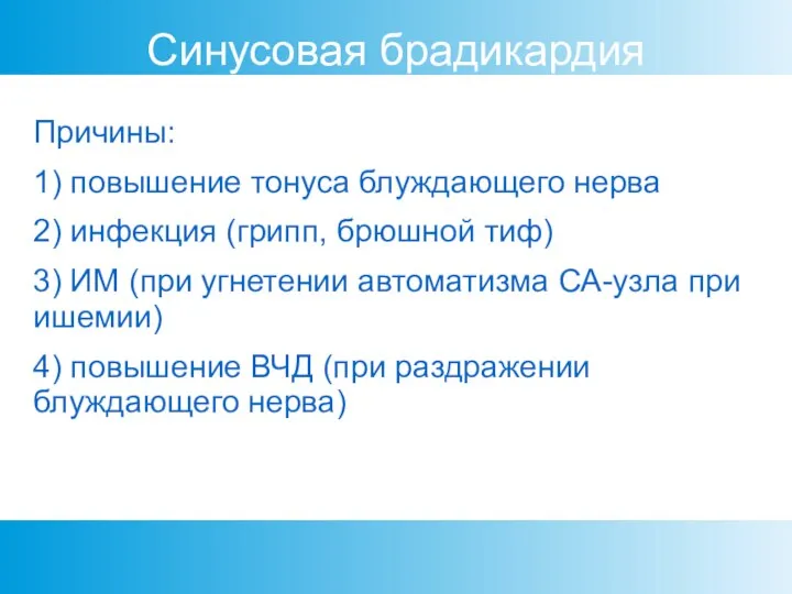 Синусовая брадикардия Причины: 1) повышение тонуса блуждающего нерва 2) инфекция (грипп, брюшной