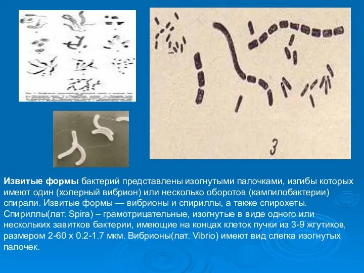 Извитые формы бактерий представлены изогнутыми палочками, изгибы которых имеют один (холерный вибрион)