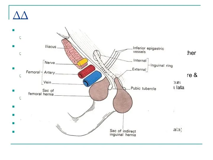 ΔΔ Femoral hernia Lie lateral & below the pubic tubercle Lymphadenopathy Mobile,