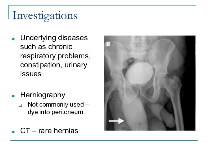 Investigations Underlying diseases such as chronic respiratory problems, constipation, urinary issues Herniography