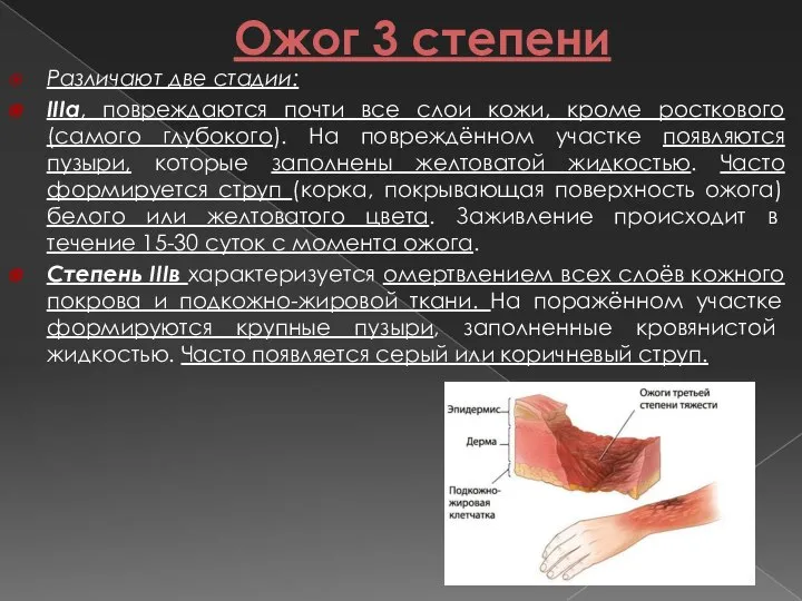 Ожог 3 степени Различают две стадии: ІІІа, повреждаются почти все слои кожи,