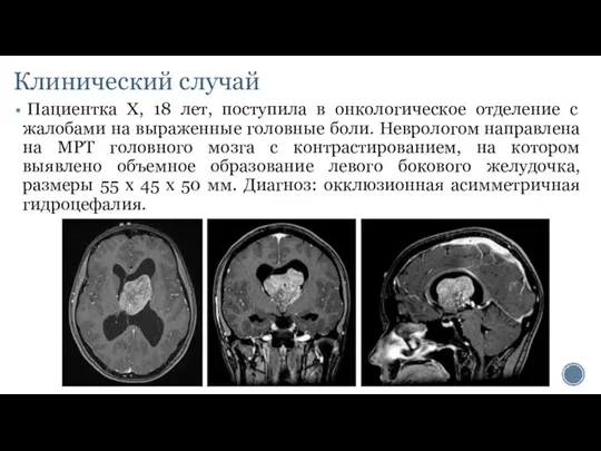 Клинический случай Пациентка Х, 18 лет, поступила в онкологическое отделение с жалобами