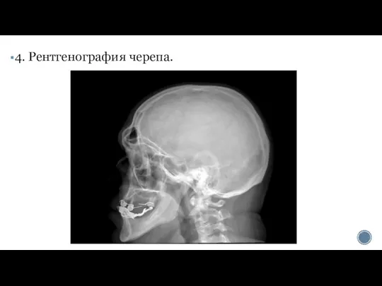 4. Рентгенография черепа.