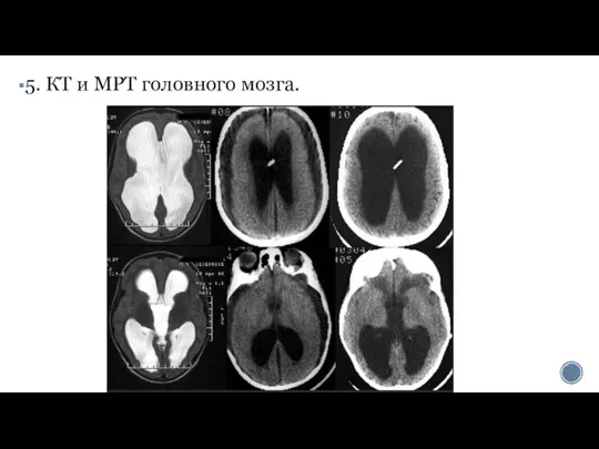 5. КТ и МРТ головного мозга.