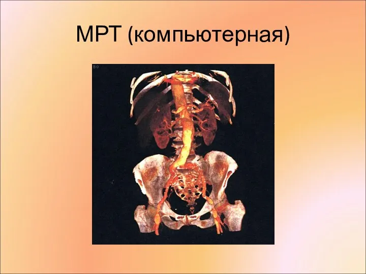 МРТ (компьютерная)