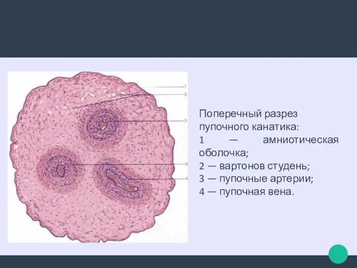 Поперечный разрез пупочного канатика: 1 — амниотическая оболочка; 2 — вартонов студень;