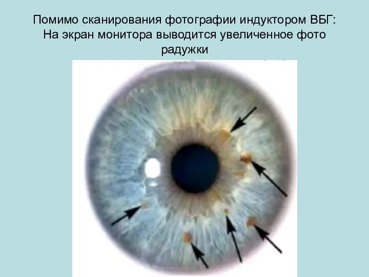 Помимо сканирования фотографии индуктором ВБГ: На экран монитора выводится увеличенное фото радужки