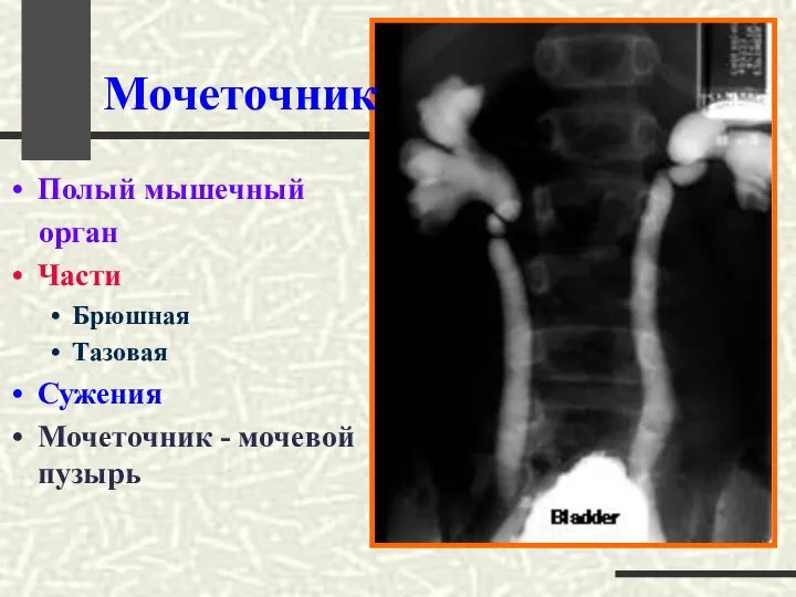 Мочеточник Полый мышечный орган Части Брюшная Тазовая Сужения Мочеточник - мочевой пузырь