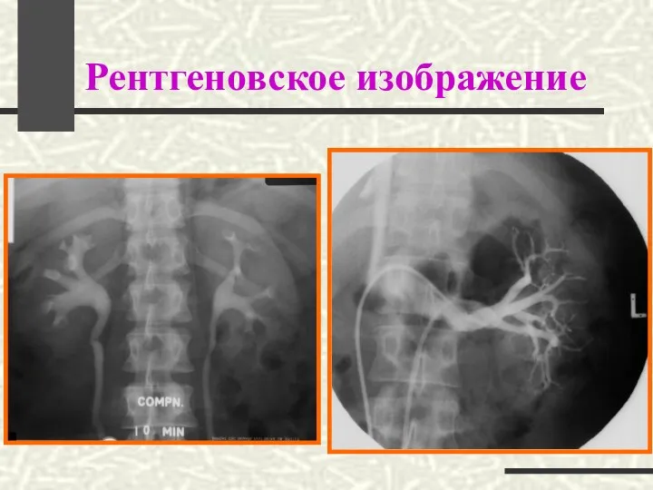 Рентгеновское изображение