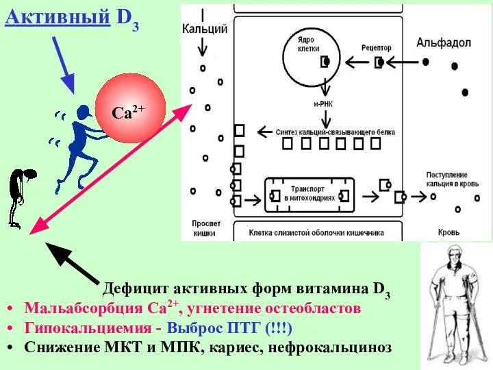 Дефицит активных форм витамина D3 Мальабсорбция Са2+, угнетение остеобластов Гипокальциемия - Выброс