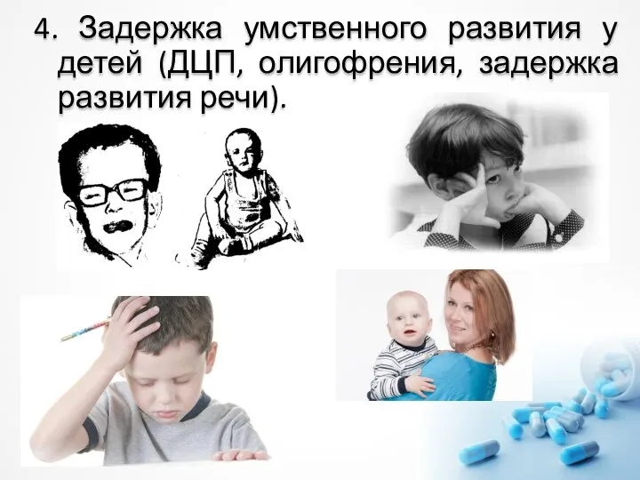 4. Задержка умственного развития у детей (ДЦП, олигофрения, задержка развития речи).
