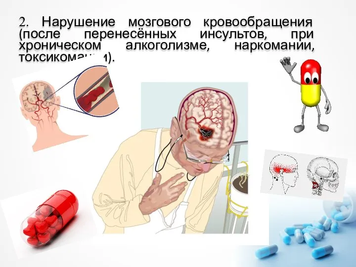 2. Нарушение мозгового кровообращения (после перенесённых инсультов, при хроническом алкоголизме, наркомании, токсикомании).