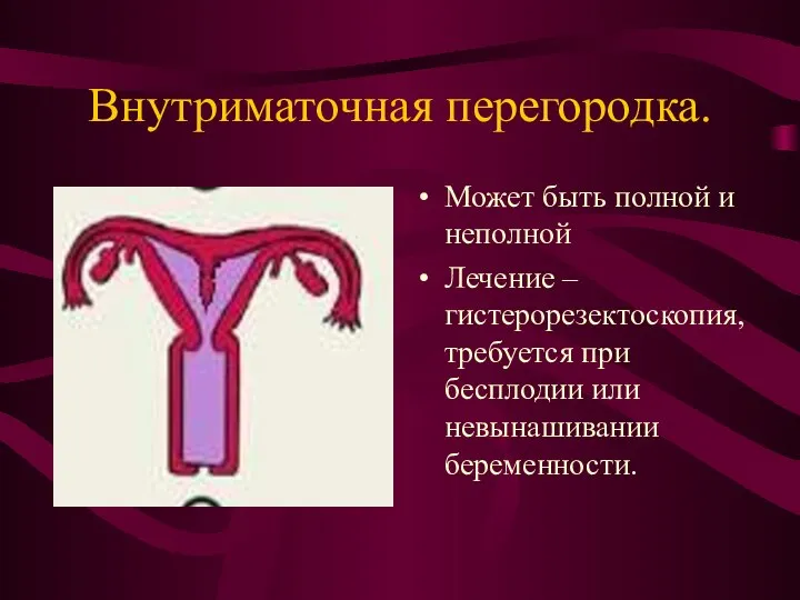 Внутриматочная перегородка. Может быть полной и неполной Лечение – гистерорезектоскопия, требуется при бесплодии или невынашивании беременности.
