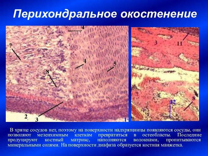 Перихондральное окостенение В хряще сосудов нет, поэтому на поверхности надхрящницы появляются сосуды,