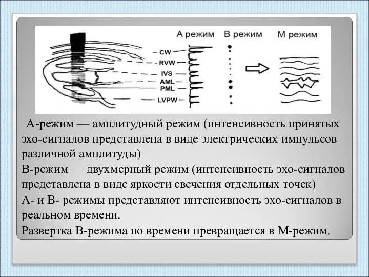 А-режим — амплитудный режим (интенсивность принятых эхо-сигналов представлена в виде электрических импульсов