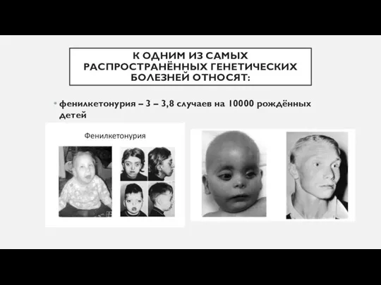 К ОДНИМ ИЗ САМЫХ РАСПРОСТРАНЁННЫХ ГЕНЕТИЧЕСКИХ БОЛЕЗНЕЙ ОТНОСЯТ: фенилкетонурия – 3 –