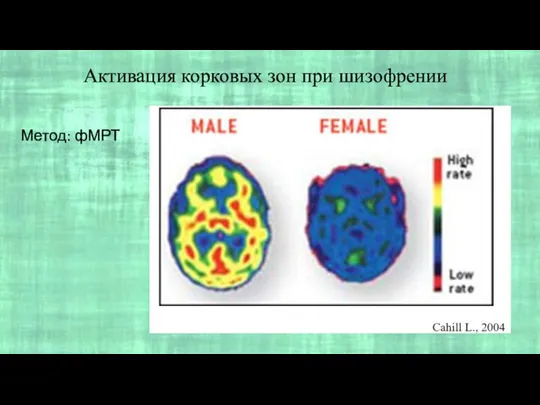 Активация корковых зон при шизофрении Метод: фМРТ