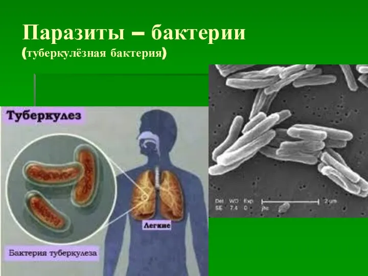 Паразиты – бактерии (туберкулёзная бактерия)