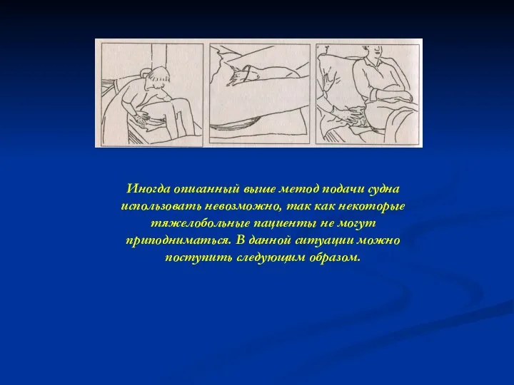 Иногда описанный выше метод подачи судна использовать невозможно, так как некоторые тяжелобольные