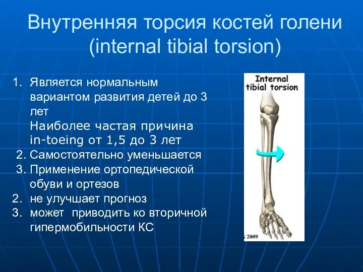 Внутренняя торсия костей голени (internal tibial torsion) Является нормальным вариантом развития детей