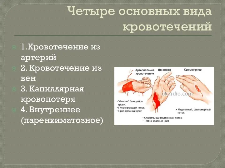 Четыре основных вида кровотечений 1.Кровотечение из артерий 2. Кровотечение из вен 3.