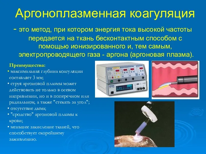 Аргоноплазменная коагуляция - это метод, при котором энергия тока высокой частоты передается