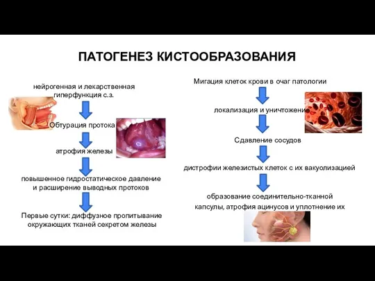 ПАТОГЕНЕЗ КИСТООБРАЗОВАНИЯ нейрогенная и лекарственная гиперфункция с.з. Обтурация протока атрофия железы повышенное