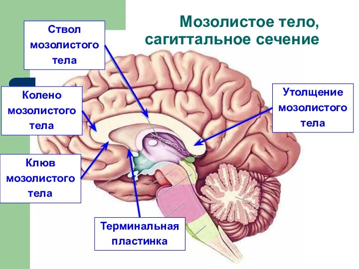 Мозолистое тело, сагиттальное сечение Утолщение мозолистого тела Ствол мозолистого тела Колено мозолистого