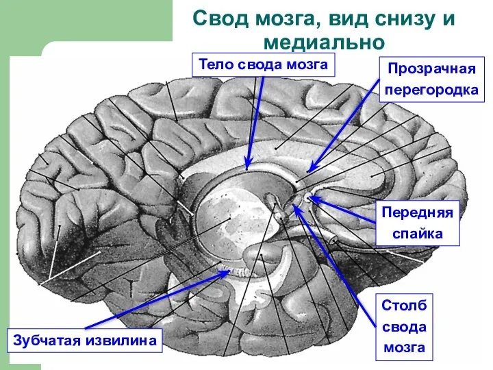 Свод мозга, вид снизу и медиально Тело свода мозга Столб свода мозга