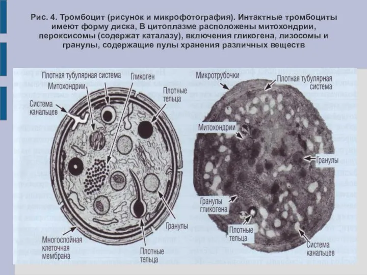 Рис. 4. Тромбоцит (рисунок и микрофотография). Интактные тромбоциты имеют форму диска, В