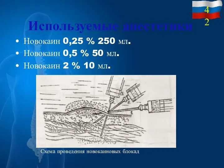 Используемые анестетики Новокаин 0,25 % 250 мл. Новокаин 0,5 % 50 мл.