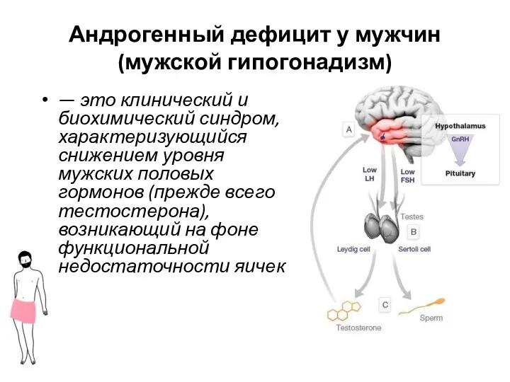 Андрогенный дефицит у мужчин (мужской гипогонадизм) — это клинический и биохимический синдром,