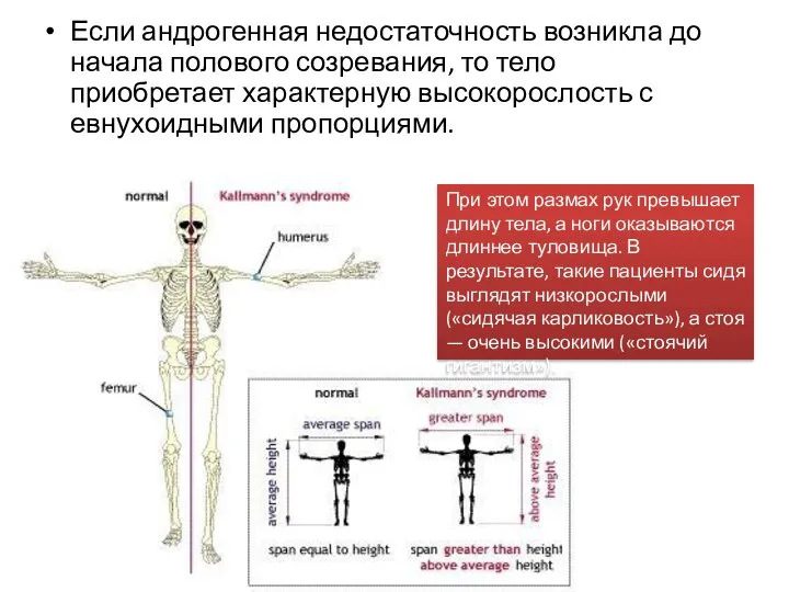 Если андрогенная недостаточность возникла до начала полового созревания, то тело приобретает характерную