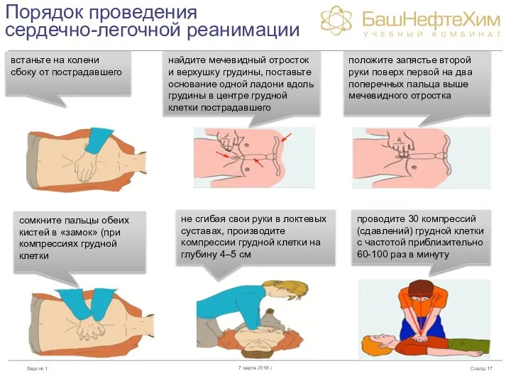 Порядок проведения сердечно-легочной реанимации Слайд 7 марта 2018 г. встаньте на колени