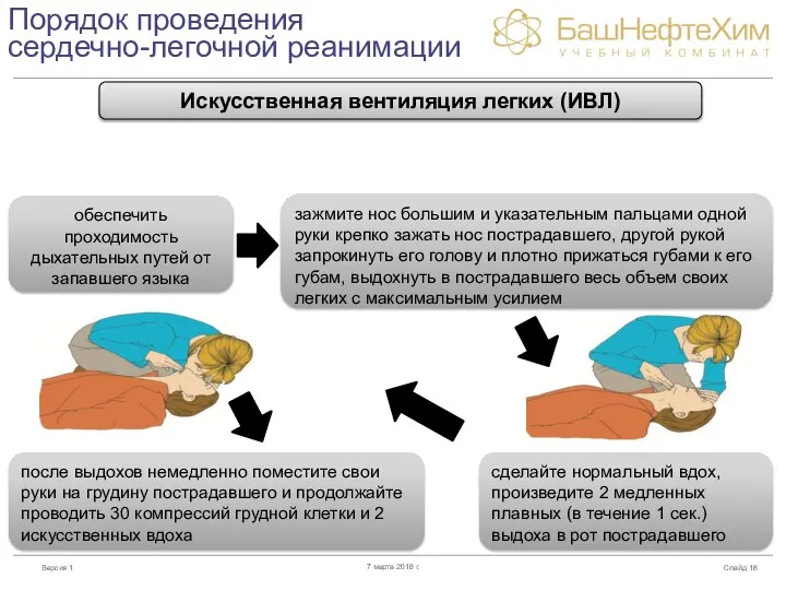 Порядок проведения сердечно-легочной реанимации Слайд 7 марта 2018 г. Искусственная вентиляция легких