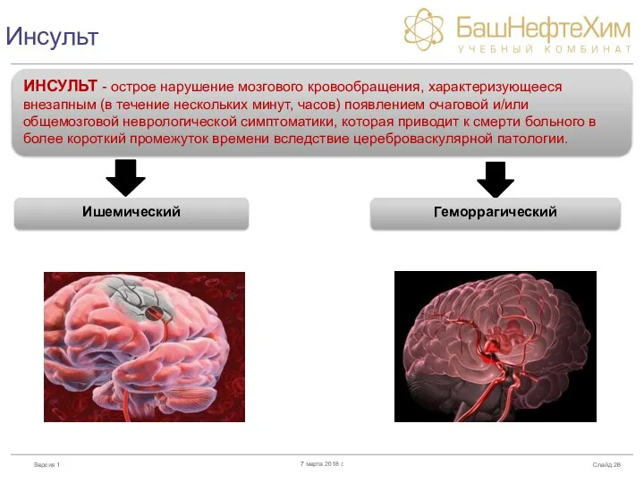 Инсульт Слайд 7 марта 2018 г. ИНСУЛЬТ - острое нарушение мозгового кровообращения,