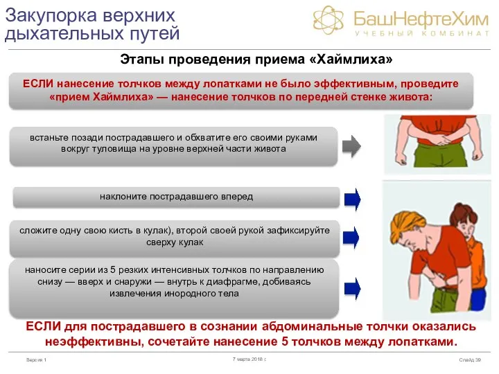 Закупорка верхних дыхательных путей Слайд 7 марта 2018 г. ЕСЛИ нанесение толчков