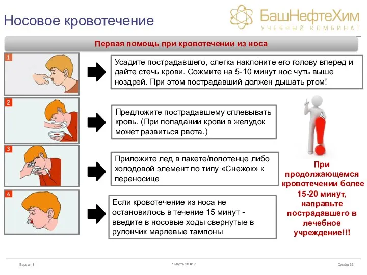 Носовое кровотечение Слайд 7 марта 2018 г. Первая помощь при кровотечении из