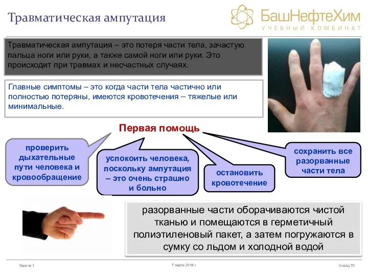 Травматическая ампутация Слайд 7 марта 2018 г. Травматическая ампутация – это потеря