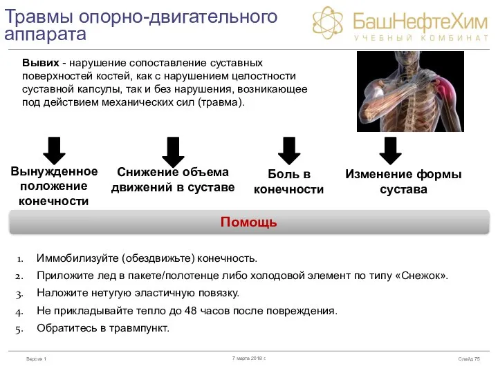 Травмы опорно-двигательного аппарата Слайд 7 марта 2018 г. Вывих - нарушение сопоставление