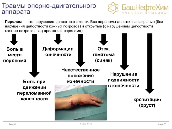 Травмы опорно-двигательного аппарата Слайд 7 марта 2018 г. Перелом — это нарушение