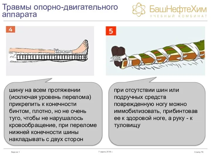 Травмы опорно-двигательного аппарата Слайд 7 марта 2018 г. шину на всем протяжении