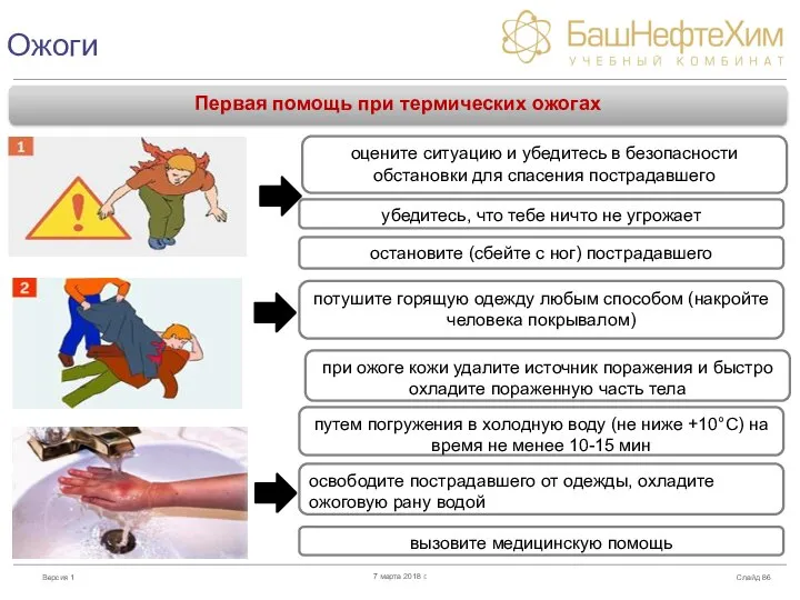 Ожоги Слайд 7 марта 2018 г. Первая помощь при термических ожогах оцените