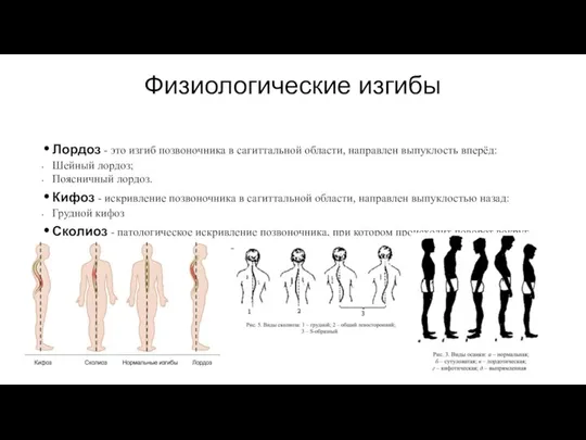 Физиологические изгибы Лордоз - это изгиб позвоночника в сагиттальной области, направлен выпуклость