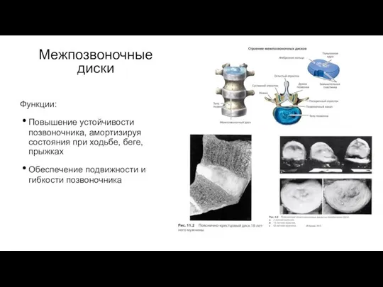 Межпозвоночные диски Функции: Повышение устойчивости позвоночника, амортизируя состояния при ходьбе, беге, прыжках