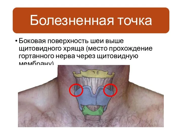 Боковая поверхность шеи выше щитовидного хряща (место прохождение гортанного нерва через щитовидную мембрану)