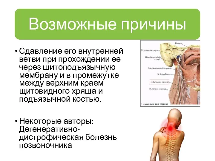 Сдавление его внутренней ветви при прохождении ее через щитоподъязычную мембрану и в