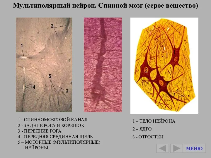 Мультиполярный нейрон. Спинной мозг (серое вещество) 1 - СПИННОМОЗГОВОЙ КАНАЛ 2 -