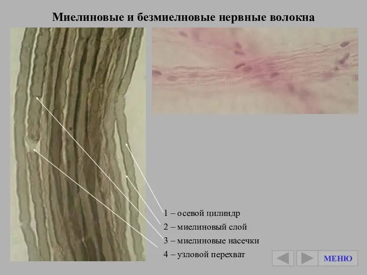 Миелиновые и безмиелновые нервные волокна 1 – осевой цилиндр 2 – миелиновый